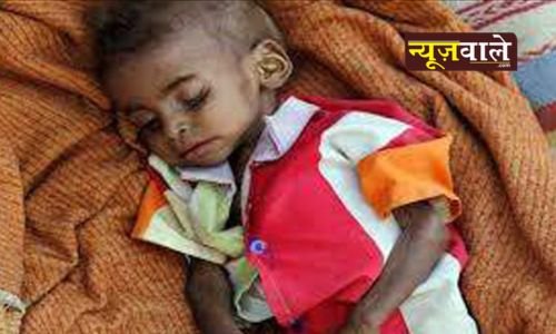 The real picture of malnutrition in Gujarat, the 'model state', is worrying